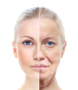 Activate Super Lifting Botox Mask