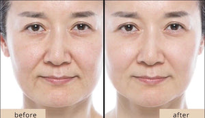 Activate Super Lifting Botox Mask